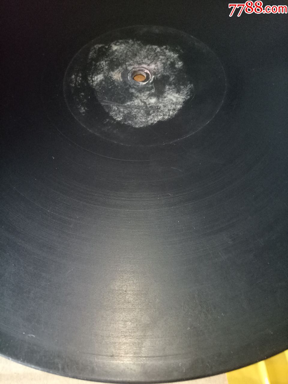 beat·365:宫颈囊肿的临床表现有哪些?(图1) beat·365