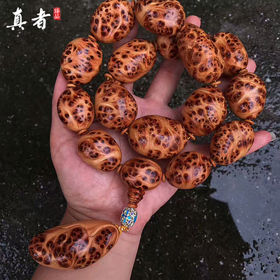 beat365亚洲体育官方网站-诱发霉菌性阴道炎的病因有哪些